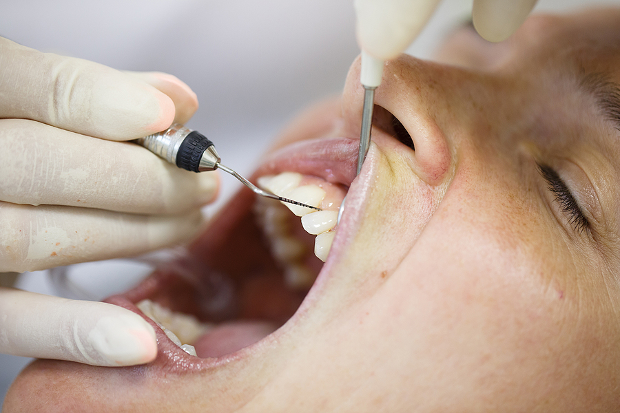 Comprehensive Care for Gum Health: Periodontal Treatment in San Mateo, CA
