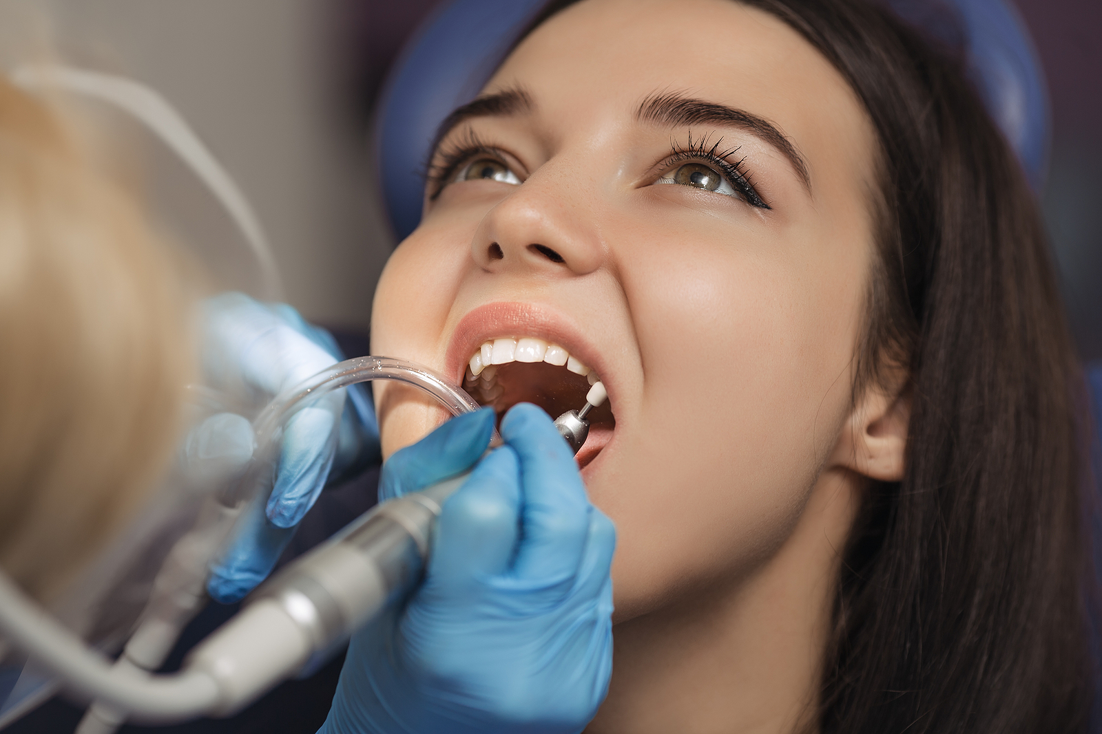 How to Care for the Extraction Site: Cleaning and Maintenance Tips